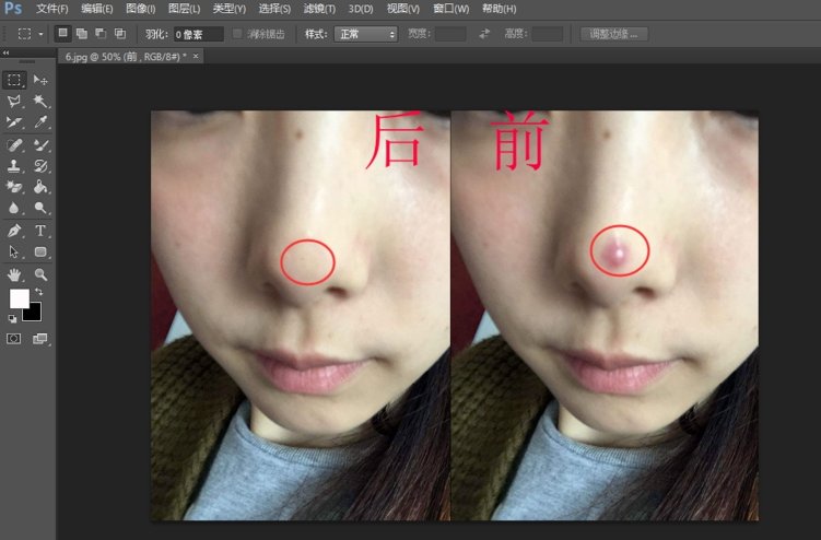 使用Photoshop为图片人物去痘印的操作方法介绍